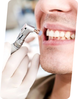 имплантация зубов иркутск